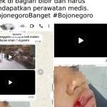 Tangkapan layar informasi dugaan pengeroyokan di depan SMP Negeri 1 Ngasem, Bojonegoro, yang beredar di media sosial. Korban dilaporkan mengalami luka pada bagian bibir.