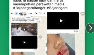 Tangkapan layar informasi dugaan pengeroyokan di depan SMP Negeri 1 Ngasem, Bojonegoro, yang beredar di media sosial. Korban dilaporkan mengalami luka pada bagian bibir.