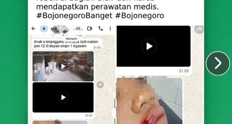 Tangkapan layar informasi dugaan pengeroyokan di depan SMP Negeri 1 Ngasem, Bojonegoro, yang beredar di media sosial. Korban dilaporkan mengalami luka pada bagian bibir.