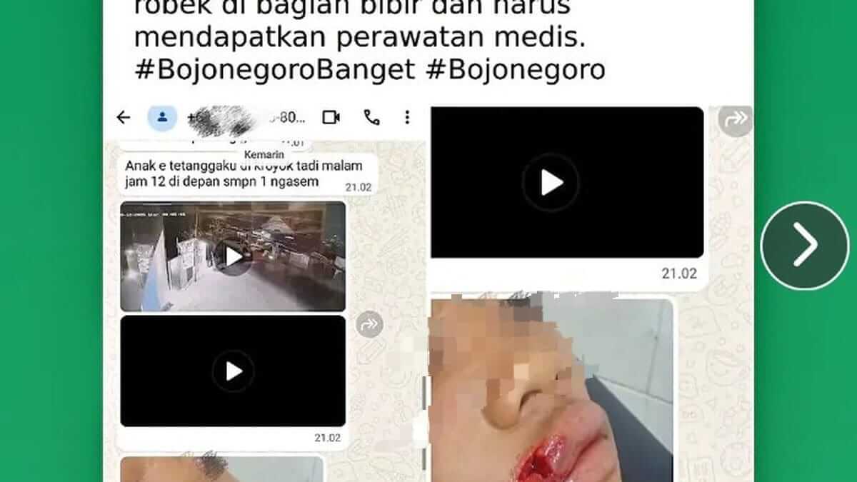 Tangkapan layar informasi dugaan pengeroyokan di depan SMP Negeri 1 Ngasem, Bojonegoro, yang beredar di media sosial. Korban dilaporkan mengalami luka pada bagian bibir.